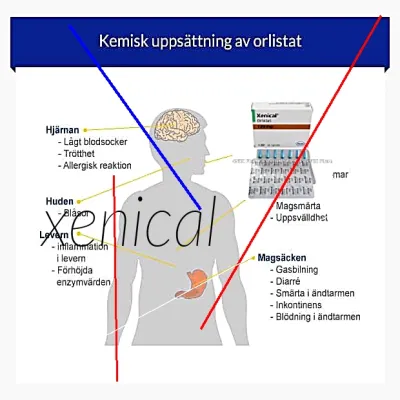 Acheter xenical moins cher